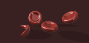 rote Blutkörperchen (normal und Sichel) – red blood cells